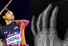 नीरज ने फ्रैक्चर के बावजूद डायमंड लीग फाइनल खेला:एक्स-रे शेयर कर किया खुलासा 2024 9image 17 49 276806964neeraj chopra reveals p