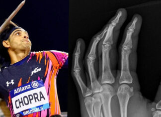 नीरज ने फ्रैक्चर के बावजूद डायमंड लीग फाइनल खेला:एक्स-रे शेयर कर किया खुलासा 2024 9image 17 49 276806964neeraj chopra reveals p